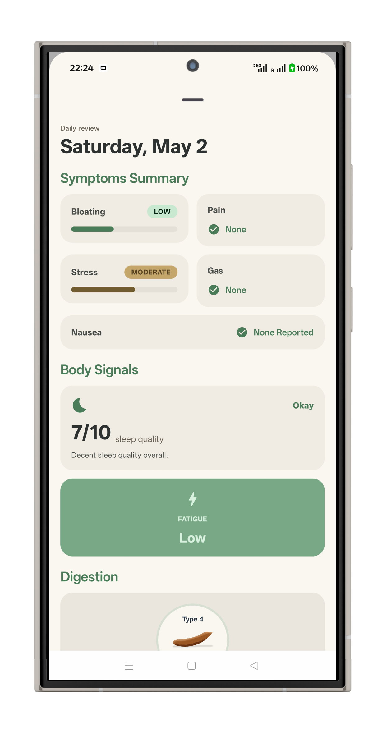 GutSignal entry detail screen mockup